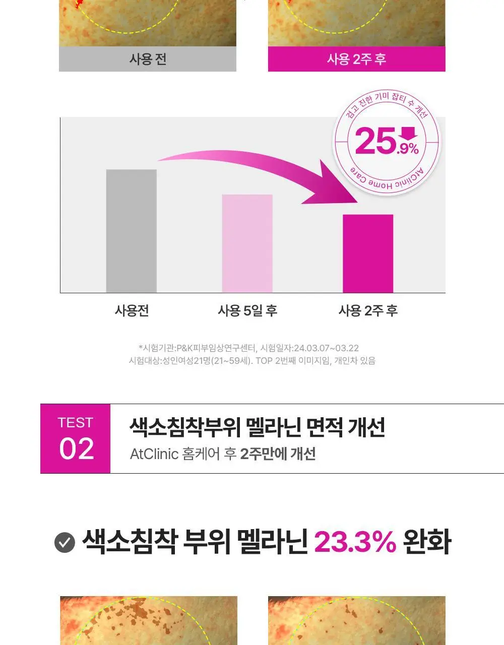[기미잡티 개선] 도미나스 앳클리닉 트라넥삼산 스팟 샷 기미잡티 앰플 30ML 상세페이지 7